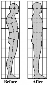 structbody