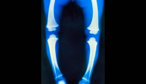 Rickets Xray