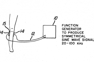 non-invasive electrical stimulation