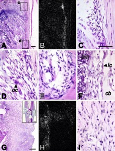 CMF608 expression