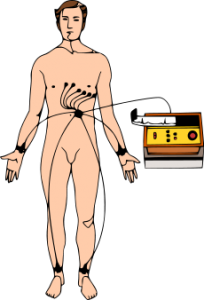 Electrocardiography