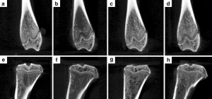 suspended non-suspended bones