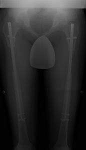 X-Rays