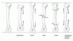 bone-loading