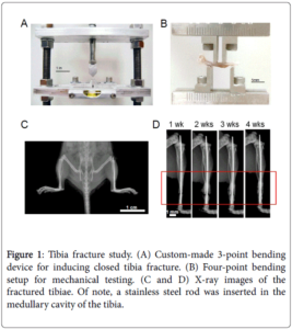 orthopedic-muscular-system-tibia-fracture-study-5-220-g001