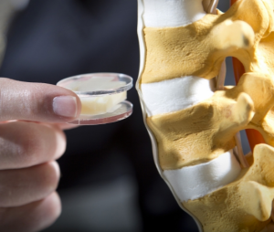 3D Printing Spinal Discs