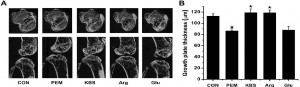 KBS on bone thickness