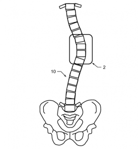 Vertebral Bone Growth