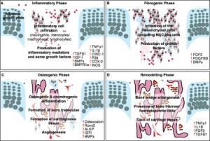 growth plate injury repair