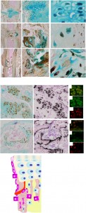 hypertrophic chondrocyte lineage