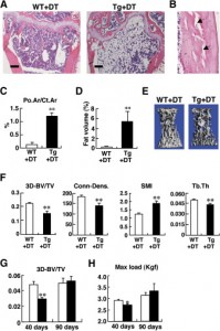 growth plates of osteocyte ablation