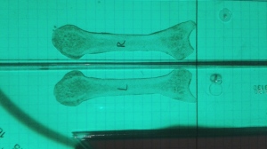 frontal index metacarpals