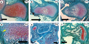 growth plate formation