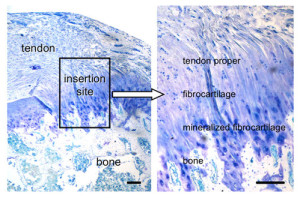 detailed view tendo enthesis