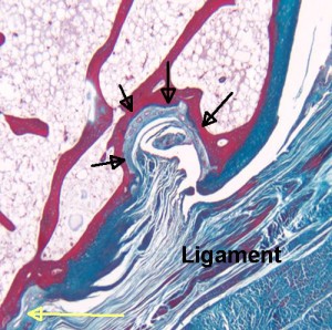 synovio epiphysis complex