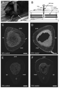 bone loading without drilling