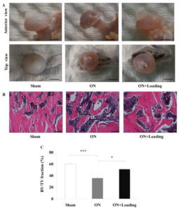 Bone, Accepted manuscript. doi:10.1016/j.bone.2015.09.012