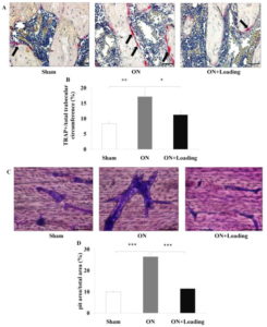 Bone, Accepted manuscript. doi:10.1016/j.bone.2015.09.012