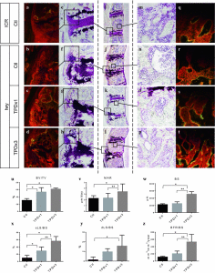 teriparatide effects