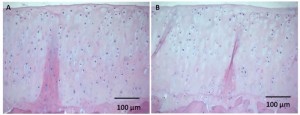 loading on chondrocytes