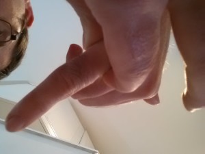 proximal finger pinch