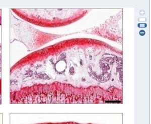 cell migration