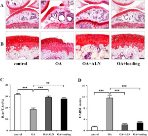 loading affect on subchondral bone2