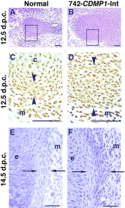 mesenchymal condensation