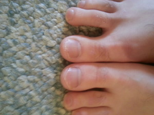 toe before