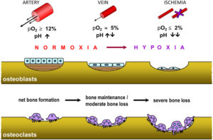 hypoxia